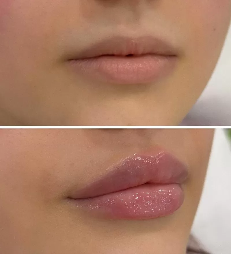 Красота начинается с заботы о себе! 2